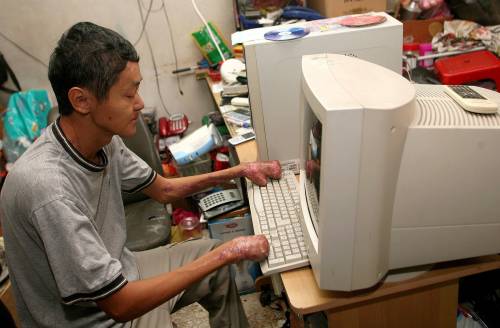 虽然没有手指，杨玉权还是可用电脑来上网和作环保品回收记录。（图：星洲日报）
