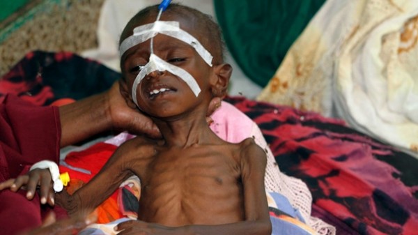 Horn of Africa: “The children’s famine” (image from www.euronews.net)