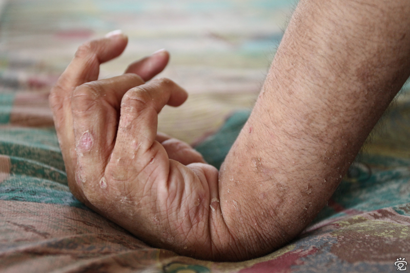 hand of a resident of the centre