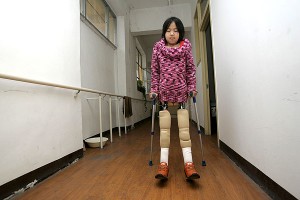 Qian now has a pair of proper prosthetic legs, but still says she likes to use the basketball from time to time as it is easier for her to get in and out of the pool with. (photo from http://www.weirdasianews.com)
