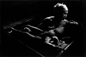 The long term effects of environmental industrial mercury poisoning on the local population in Minamata, Japan. Taken on the Japanese Island of Kyushu, we see an outwardly healthy mother bathing her fetal-poisoned 16 year old daughter, Tomoko Uemura, grotesquely deformed, physically crippled and blind since birth due to environmental industial mercury poisoning in the local water supply. (photo by W. Eugene Smith)