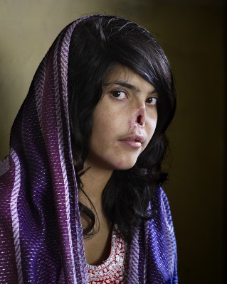 World Press Photo of the Year 2010 Jodi Bieber, South Africa, Institute for Artist Management/Goodman Gallery for Time magazine